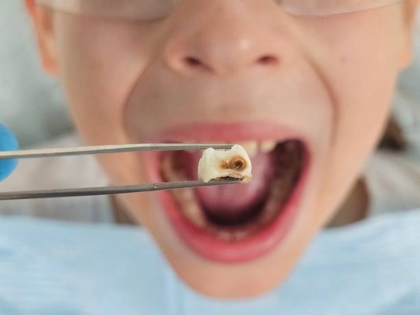 Best Emergency Pediatric Dentist  in Roselawn, IN